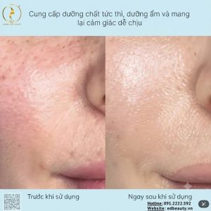 Kem c-PDRN®dưỡng phục hồi da Rejuran Nutritive Cream