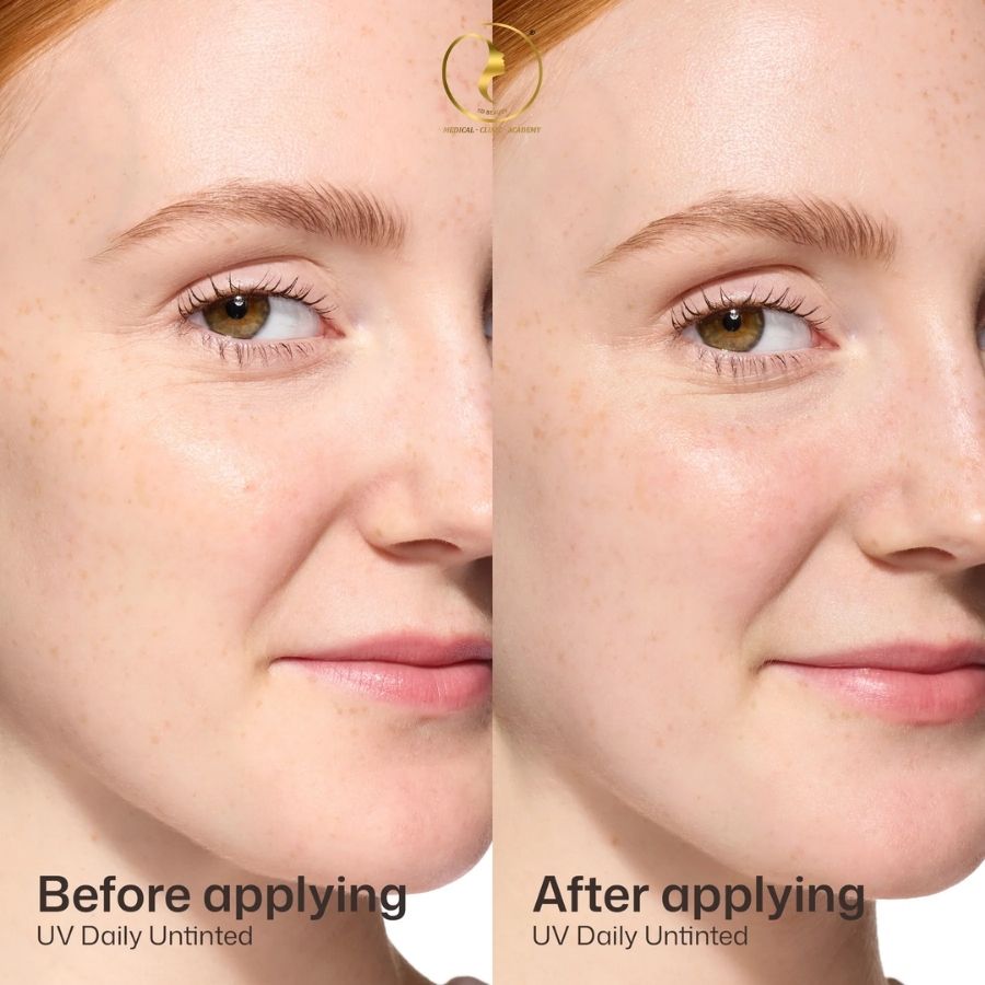 Kem chống nắng EltaMD UV Daily SPF 40 phiên bản giới hạn tại ED Beauty
