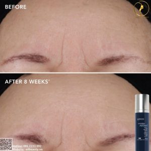 Lưu ý khi sử dụng Ageless+ Retinol 1.2%