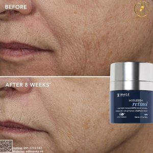 Hiệu quả khi dùng Image Retinol Overnight Masque