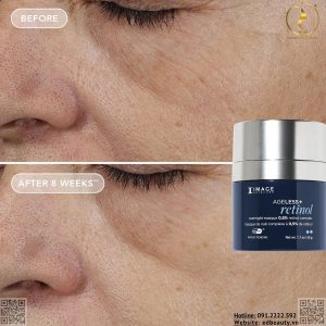 AGELESS+ Retinol 0.5% Masque phù hợp với ai?