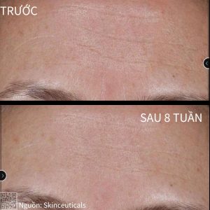 Hiệu quả sử dụng SkinCeuticals Cell Cycle Catalyst™