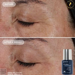 Hiệu quả khi dùng Ageless+ Pure Liquid Retinol 0.1%