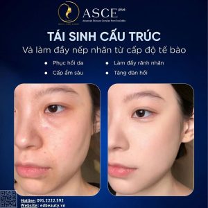 Hướng dẫn sử dụng ASCE EXO-R5 Platinum