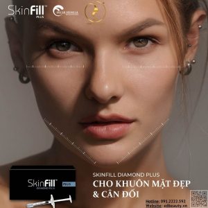 HA làm đầy nếp nhăn sâu, định hình khuôn mặt SkinFill Diamond Plus - Ảnh 2