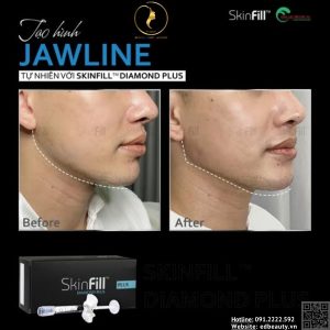 Chỉ định của SkinFill Diamond Plus