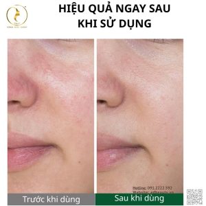 Hiệu quả khi dùng Bio Renaturation Repair Premium Mask Pack