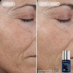 Serum trẻ hóa da dầu Image Skincare Ageless+ Retinol Pure Liquid 0.3% - Ảnh 5