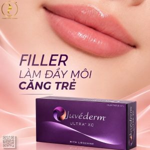 Các bạn đi làm lúc 8h đến 17h, nhắc nhở 1 lần hôm nay. Nếu từ tuần sau mà tiếp tục đi trễ giờ. Juvederm Ultra XC (