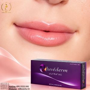 Filler Juvéderm® Ultra XC môi căng đầy