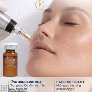 Hyaestic EXO-Lift phù hợp với ai?