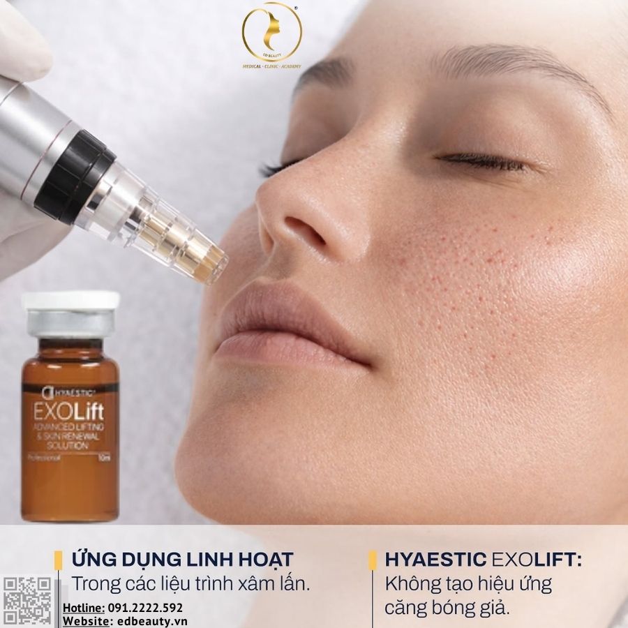 Hyaestic EXO-Lift phù hợp với ai?